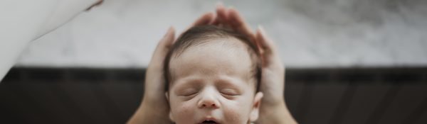 Neonato con torcicollo miogeno